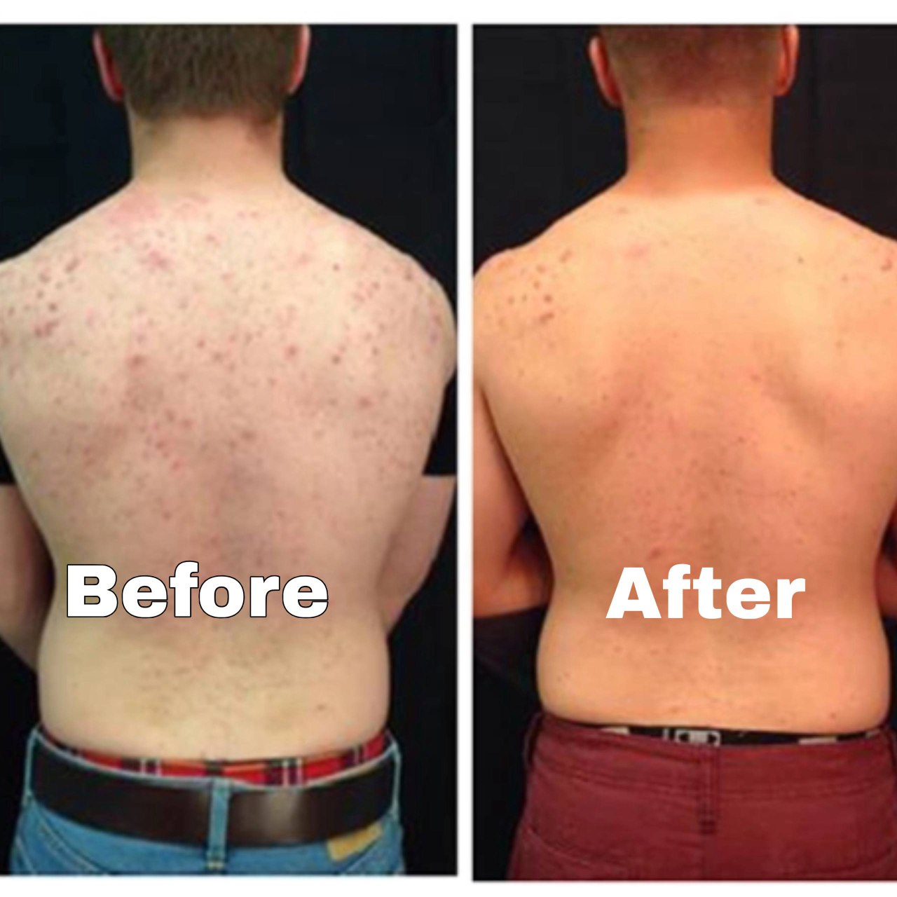 Ocean Halo Peel Shot